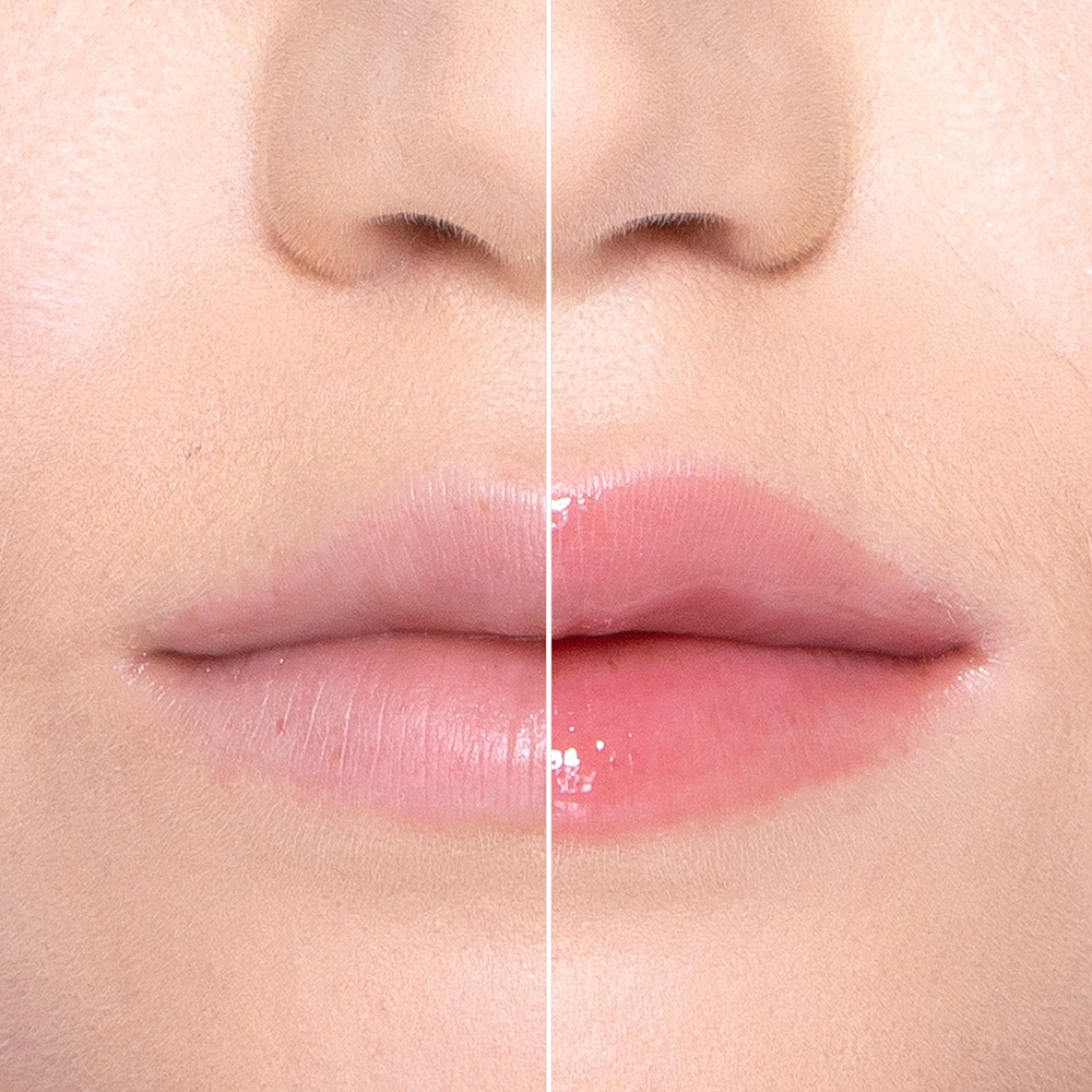 Lip Injection Extreme Lip Plumper