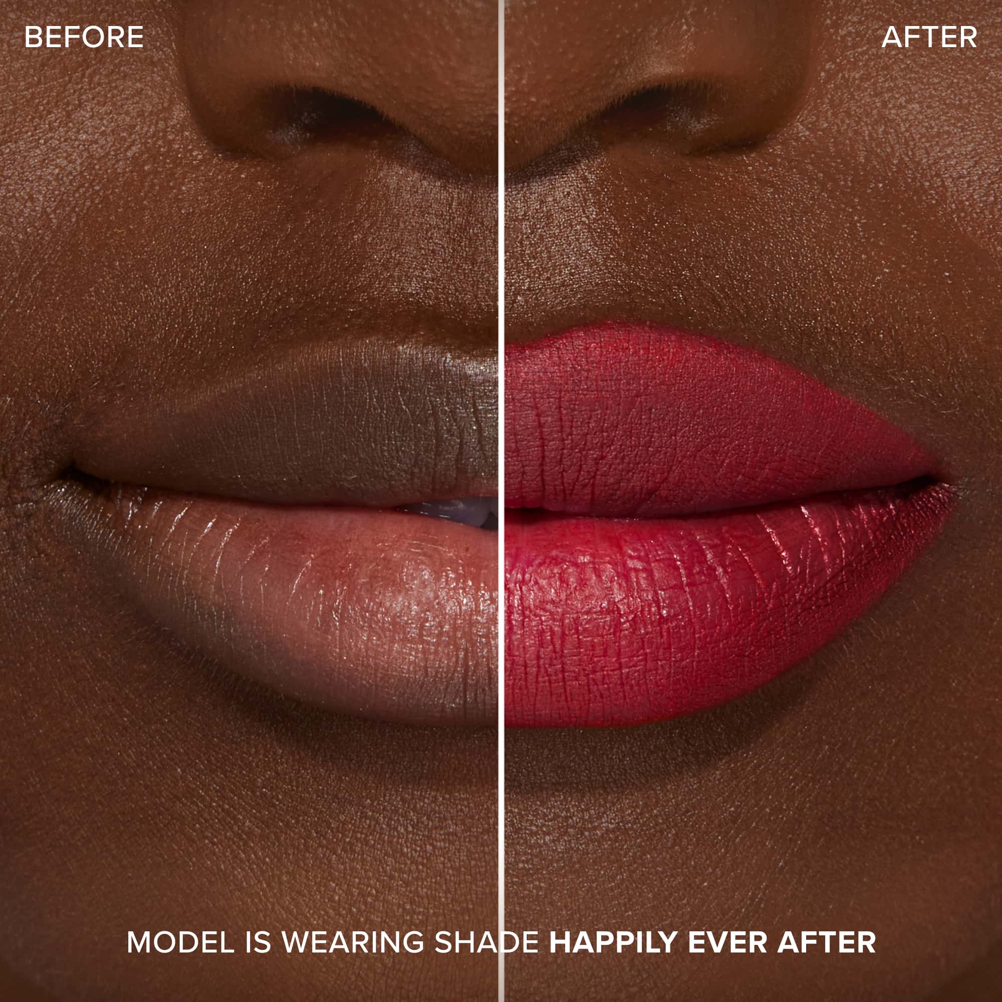 Lip Injection Extreme Lip Shaper