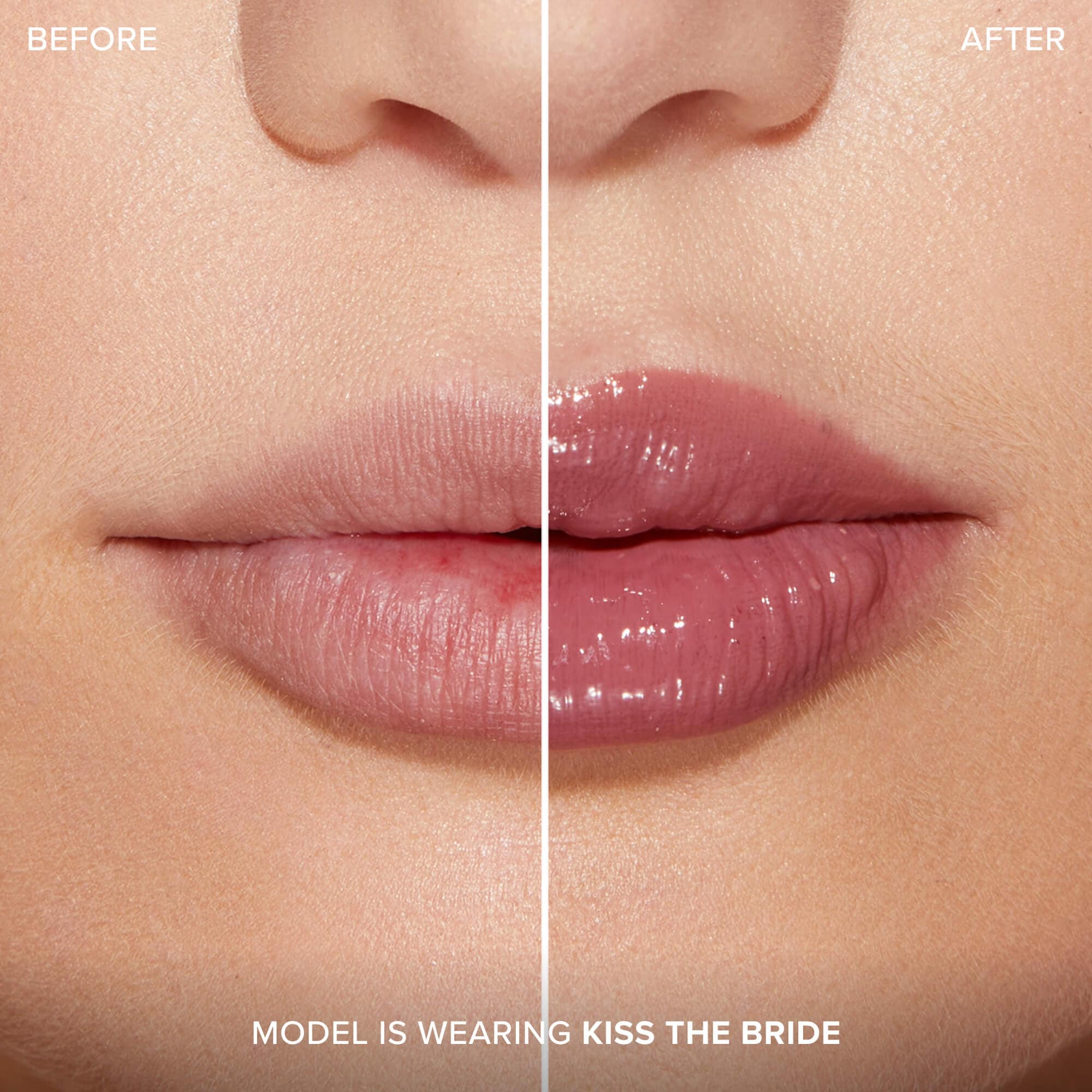 Lip Injection Extreme Plumping Clicks