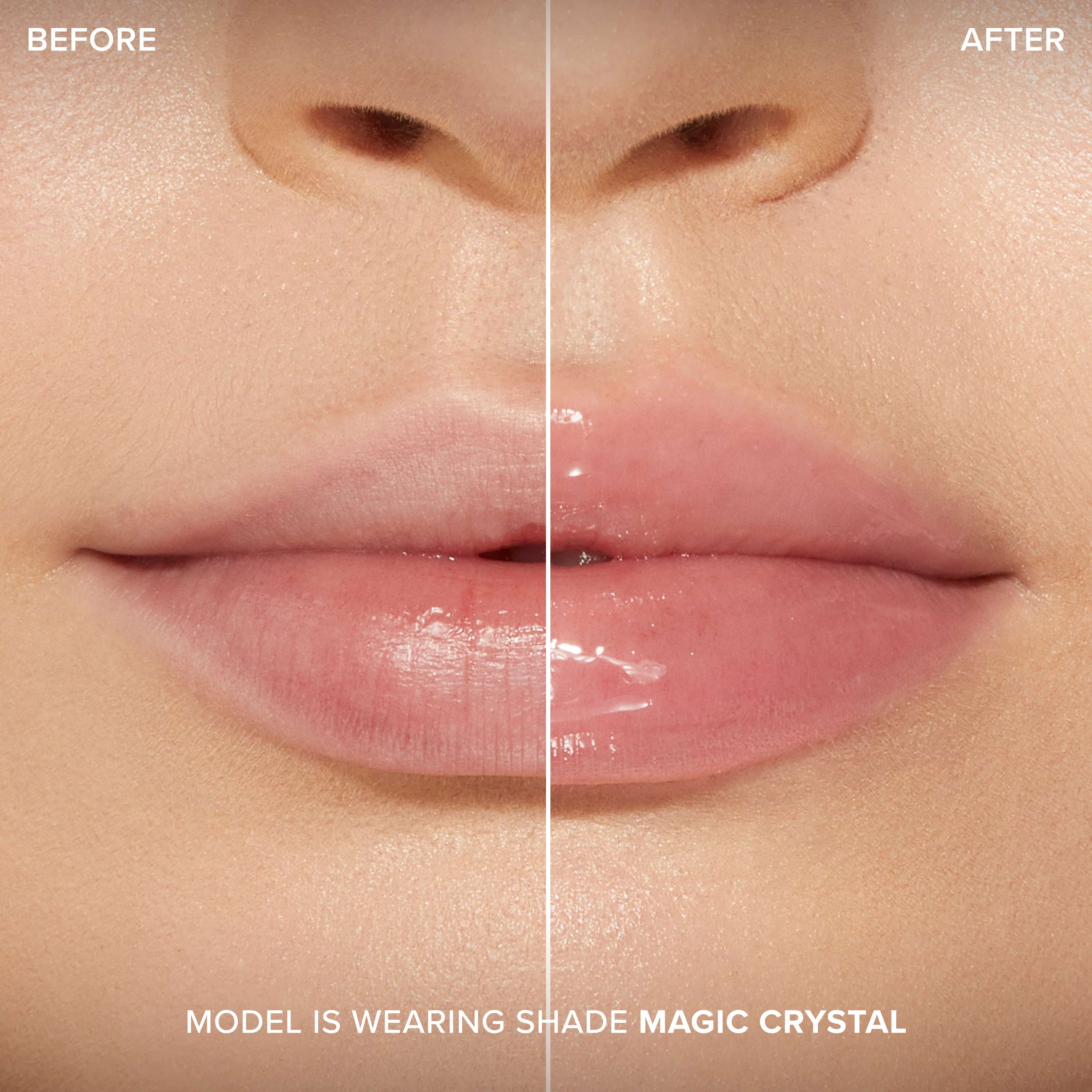 Lip Injection Maximum Plump