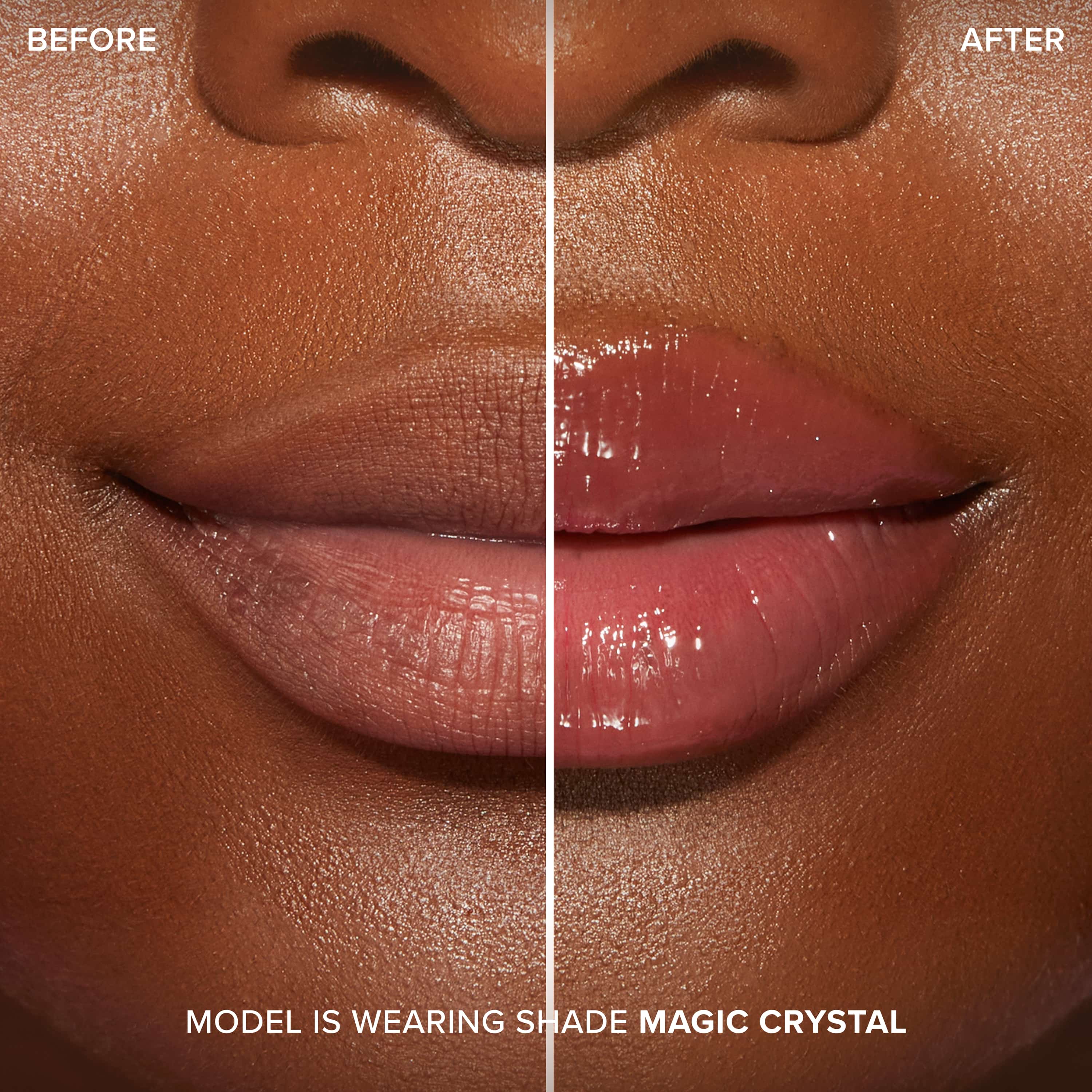 Lip Injection Maximum Plump